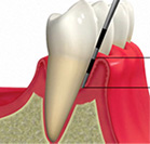 歯周組織検査（歯肉の状態、歯周病の進行度を検査）、咬み合わせの検査