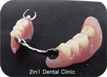 ノンクラスプと磁石を組み合わせたチタン義歯